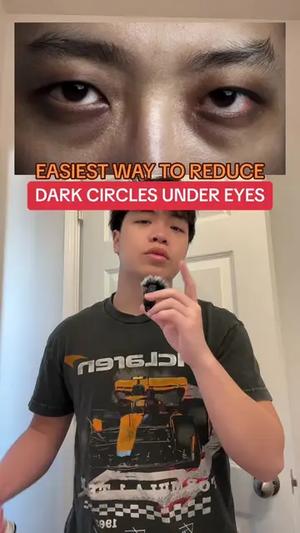 #theordinary is genuinely goated!! #eyeserum #darkcircles #eyepuffiness #SkinCare101 #health 