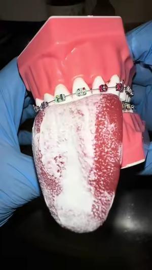 Me and my family use this daily! #waterflosser #waterflossing #badbreath #badbreathtreatment 