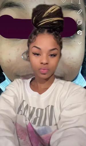 (Repost) In my option/ from my experience  kojic acid helps the most with hyperpigmentation(dark spots) the most for me ! ###greenscreen##kojicacidsoap